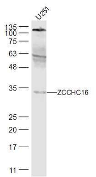 ZCCHC16 Polyclonal Antibody