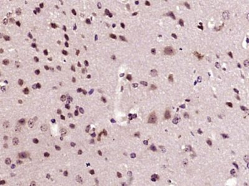 ZCCHC10 Polyclonal Antibody