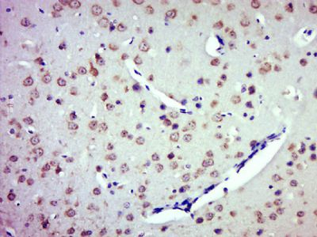 ZDHHC8/ZNF378 Polyclonal Antibody