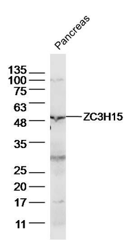 ZC3H15 Polyclonal Antibody