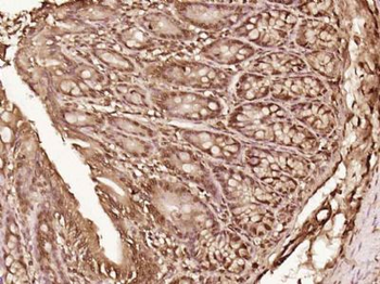 LTV1/C6orf93 Polyclonal Antibody