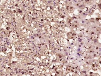 LTV1/C6orf93 Polyclonal Antibody