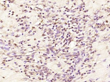 LOR/Loricrin Polyclonal Antibody