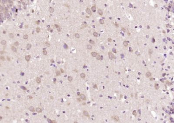 LNX1 Polyclonal Antibody
