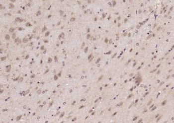 LNX1 Polyclonal Antibody