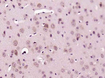 LIMCH1 Polyclonal Antibody