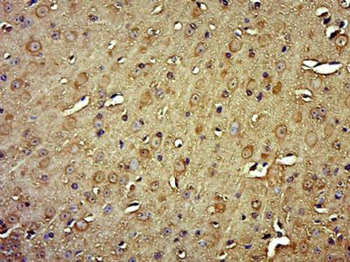 HYLS1 Polyclonal Antibody