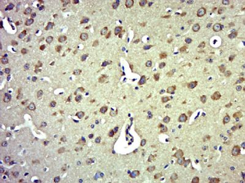 MTX3 Polyclonal Antibody