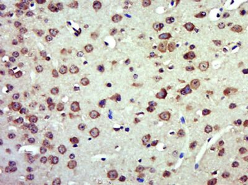 MTFMT Polyclonal Antibody