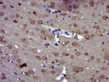 MRPS7 Polyclonal Antibody