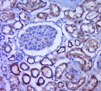 MRPS11 Polyclonal Antibody