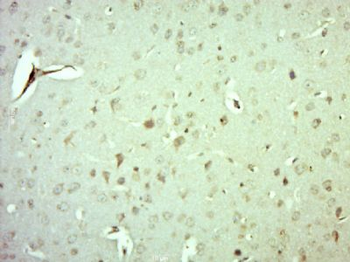MRPS10 Polyclonal Antibody