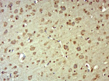 MRPL2 Polyclonal Antibody