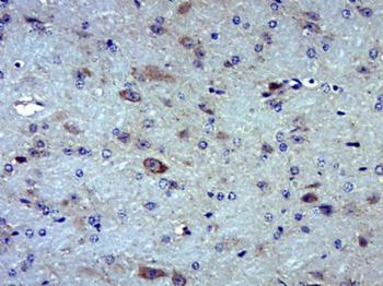 MOXD1 Polyclonal Antibody