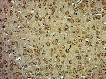 MORN4/C10orf83 Polyclonal Antibody