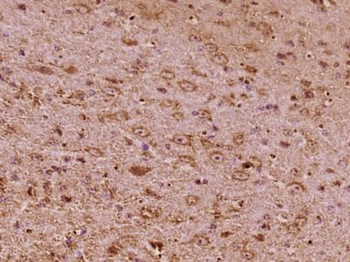 SPINK6 Polyclonal Antibody