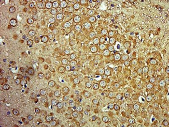 SPTBN3 Polyclonal Antibody