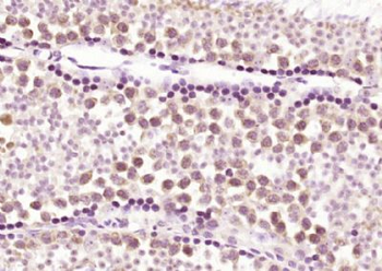 TET3 Polyclonal Antibody