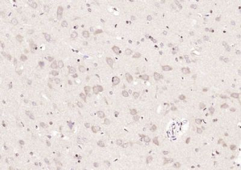 METTL3 Polyclonal Antibody