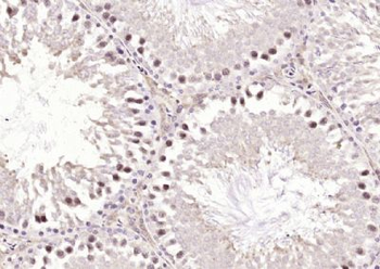 METTL3 Polyclonal Antibody
