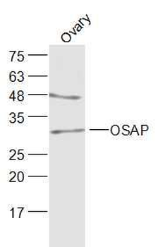 OSAP/Ovary-specific acidic protein Polyclonal Antibody