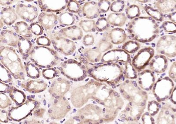 OSBPL9 Polyclonal Antibody
