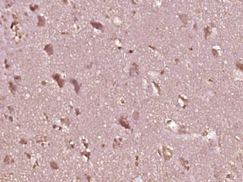 OSBPL7 Polyclonal Antibody