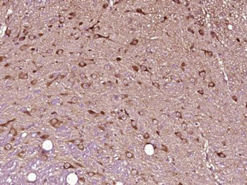 OSBPL6 Polyclonal Antibody