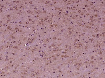 OSBPL6 Polyclonal Antibody