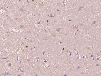 OSBPL5 Polyclonal Antibody