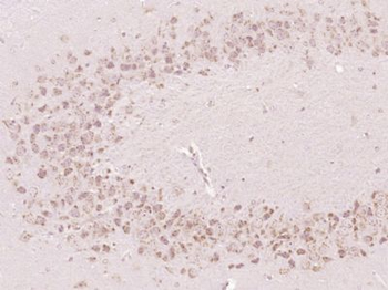 OSBPL11 Polyclonal Antibody