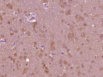 SIPA1L1 Polyclonal Antibody