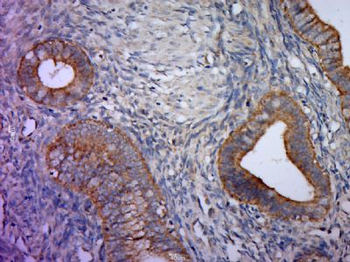 Shroom 3 Polyclonal Antibody