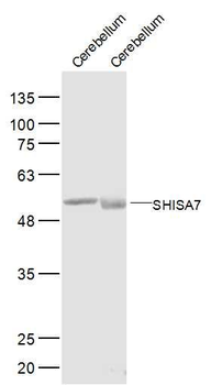 SHISA7 Polyclonal Antibody