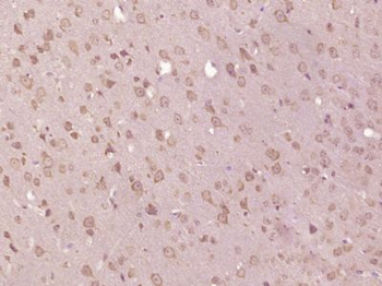HPCAL4 Polyclonal Antibody