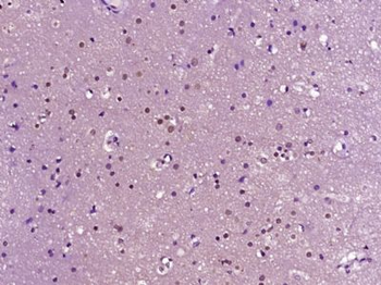 HP1BP3 Polyclonal Antibody