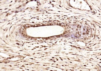 hnRNP H3 Polyclonal Antibody