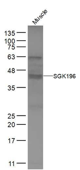 SGK196 Polyclonal Antibody
