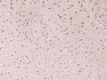 SFRS5 Polyclonal Antibody