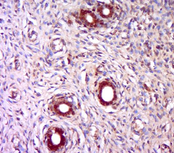 TPRKB Polyclonal Antibody