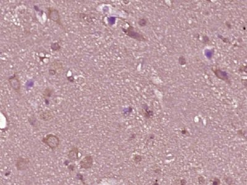 KAZALD1 Polyclonal Antibody