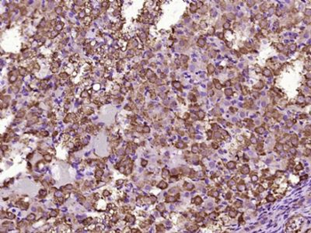 Kinectin 1 Polyclonal Antibody