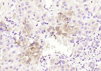 Kindlin Polyclonal Antibody