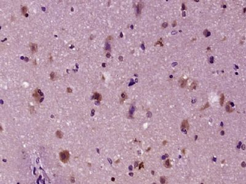 KIF26A Polyclonal Antibody