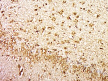 KIAA1161 Polyclonal Antibody