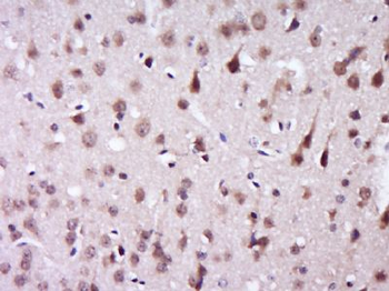 KIAA0494 Polyclonal Antibody