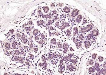 HSP20 Polyclonal Antibody