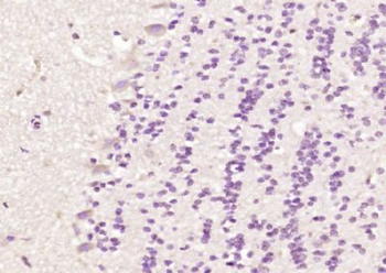 CTNNAL1 Polyclonal Antibody
