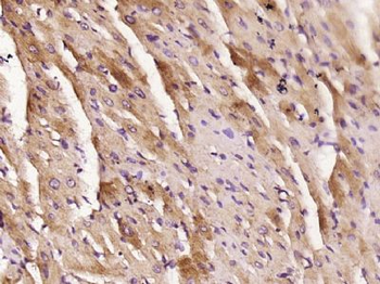 KLHL38 Polyclonal Antibody
