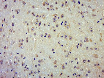 TRAPPCL2 Polyclonal Antibody